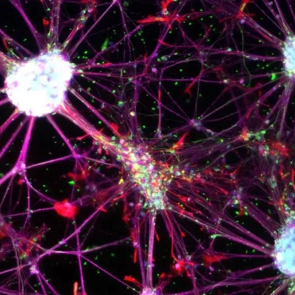 Peripheral Neuropathy Stem Cell Treatment to Heal Nerve Pain