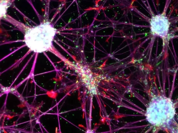 Peripheral Neuropathy Stem Cell Treatment to Heal Nerve Pain