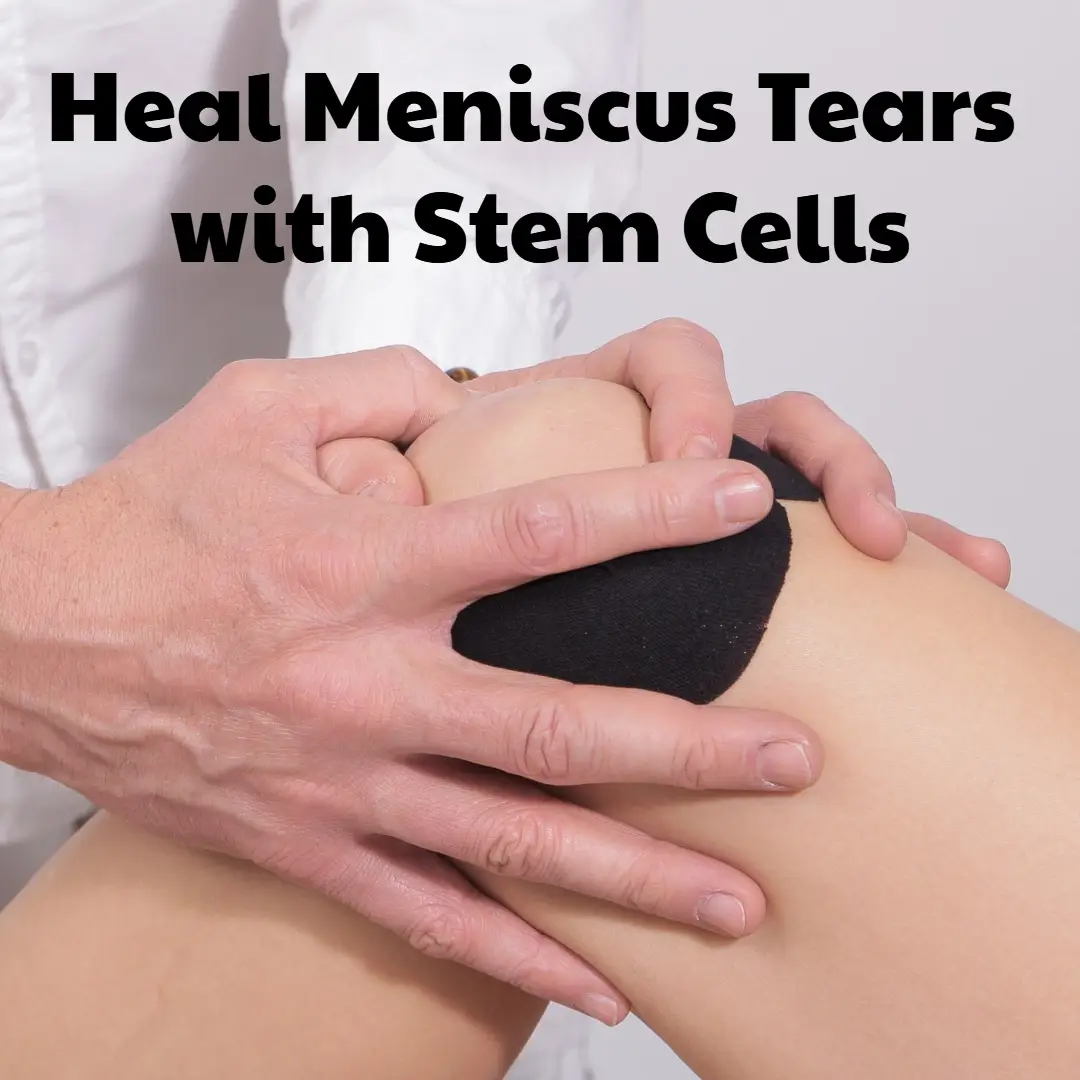 heal meniscus tears with stem cells