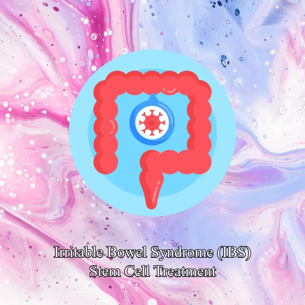 Irritable Bowel Syndrome - IBS Stem Cell Treatment
