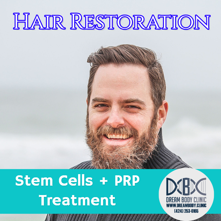 Stem Cell Hair Restoration - Get Your Hair Back Today!