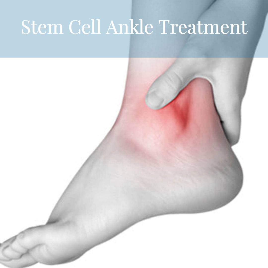 Stem Cell Ankle Repair Treatment