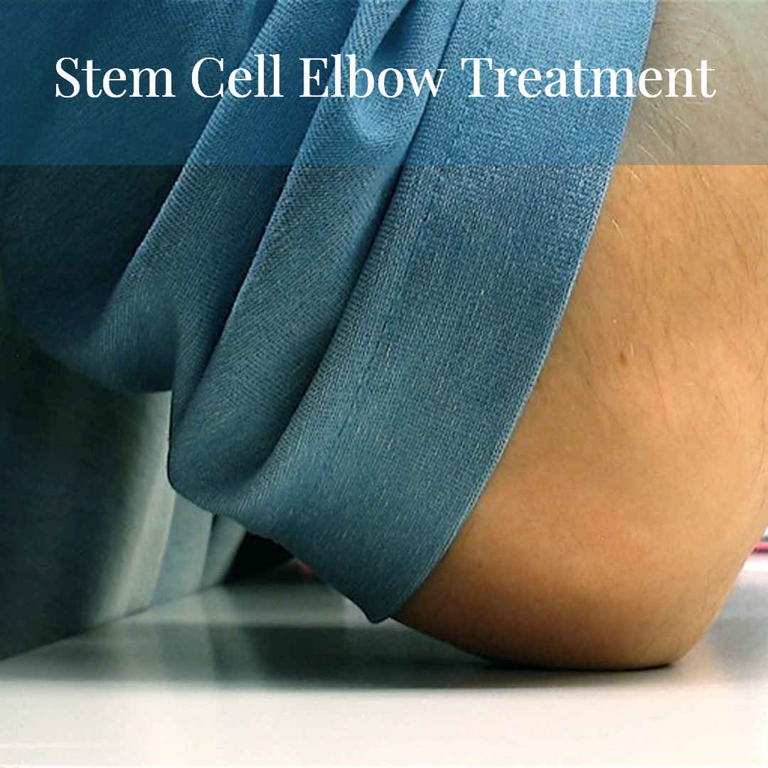 Stem Cell Elbow Repair Treatment