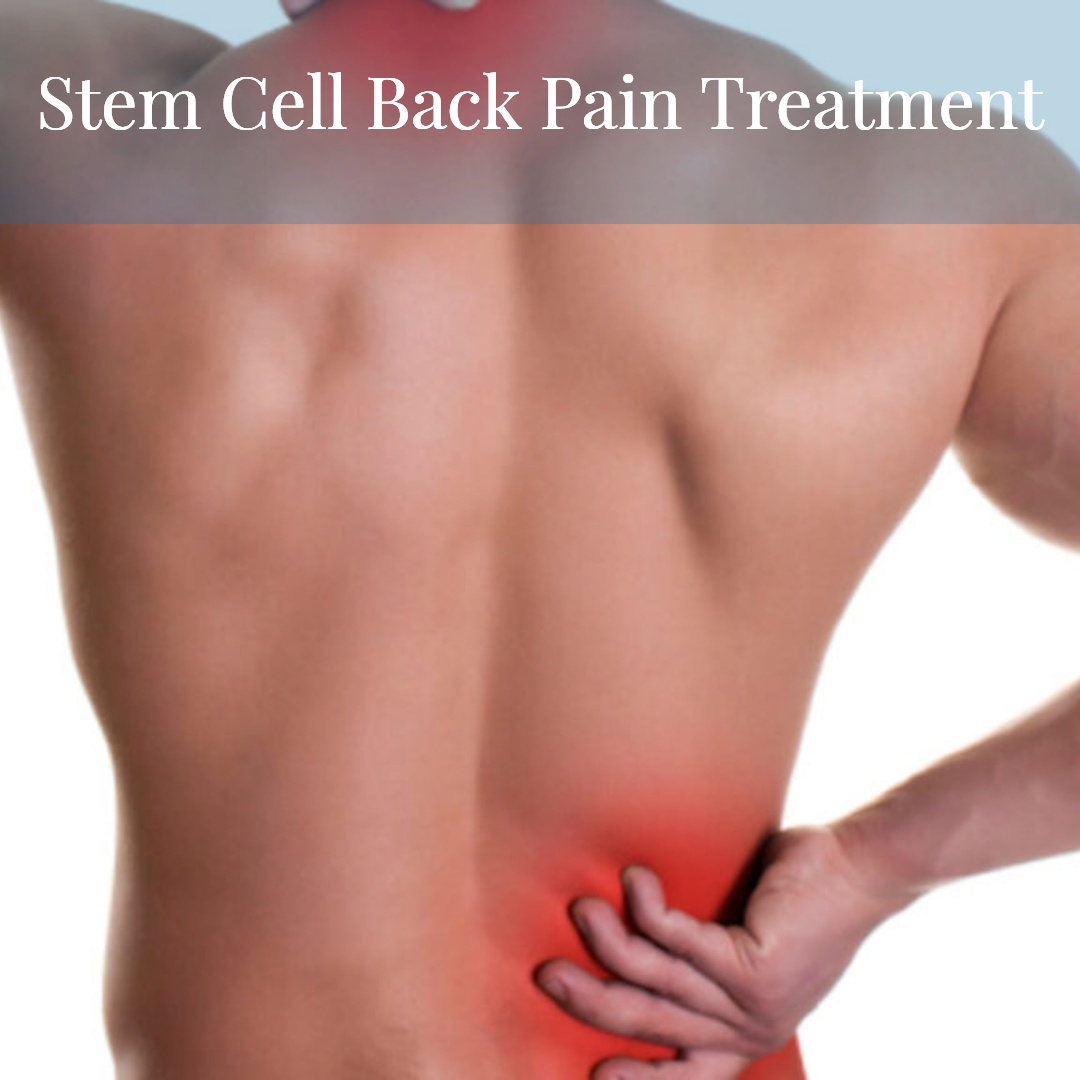 Stem Cell Back Repair Treatment