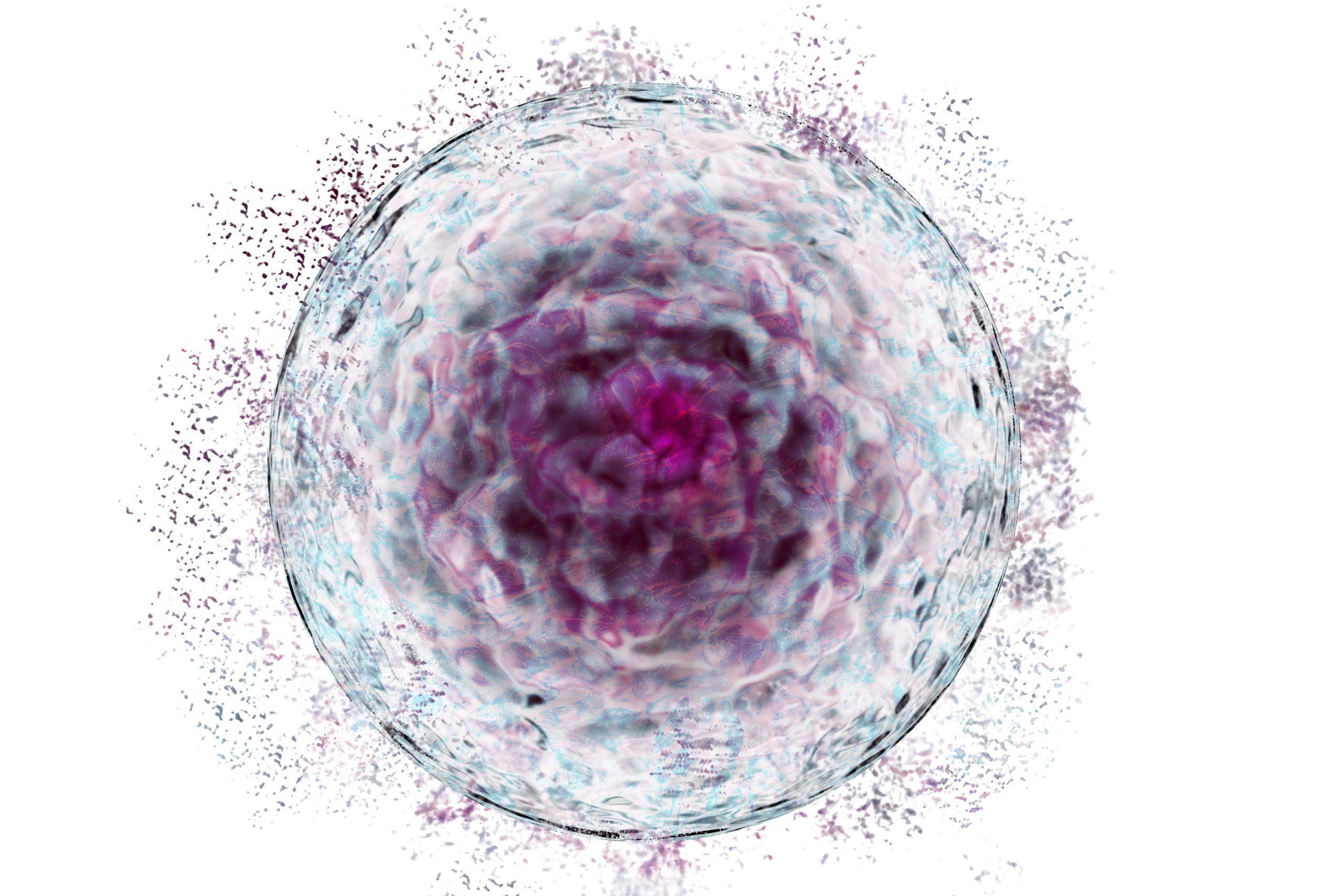 300 Million Stem Cells IV Treatment