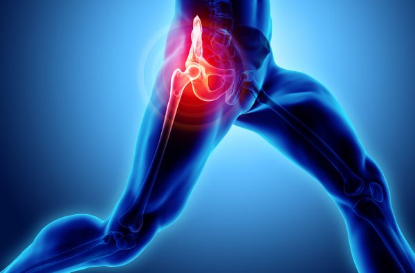 stem cell hip treatment
