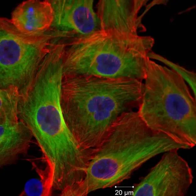 Mesenchymal stem cells study 2011 Mesenchymal stem cells study 2011