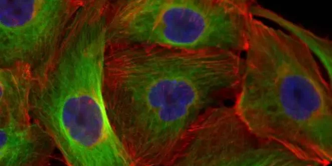 Mesenchymal stem cells study 2011