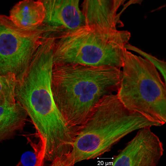 Mesenchymal stem cells study 2011