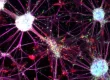 Peripheral Neuropathy Stem Cell Treatment to Heal Nerve Pain