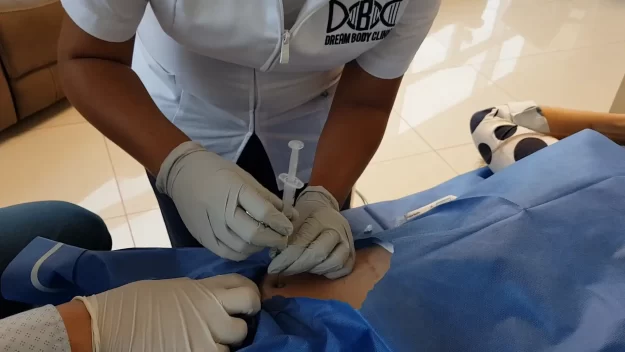 Stem Cell Hip Treatment at vallarta stem cells