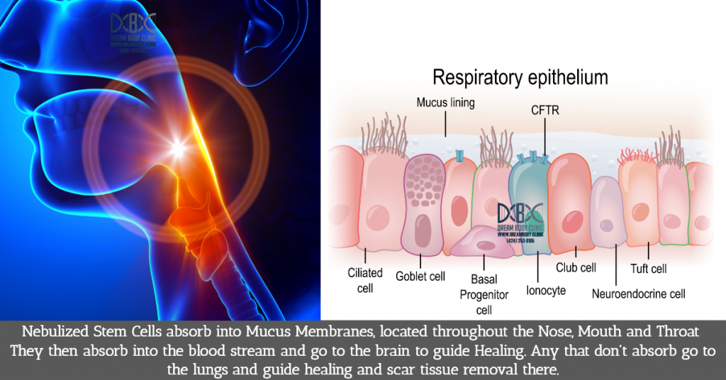 Nebulized Stem Cell Therapy for Brain Health 