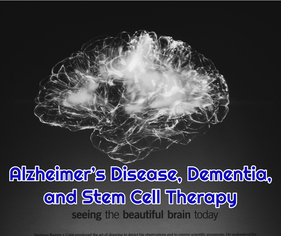 Alzheimer’s Disease, Dementia, and Stem Cell Therapy at dream body clinic alzheimers stem cell therapy