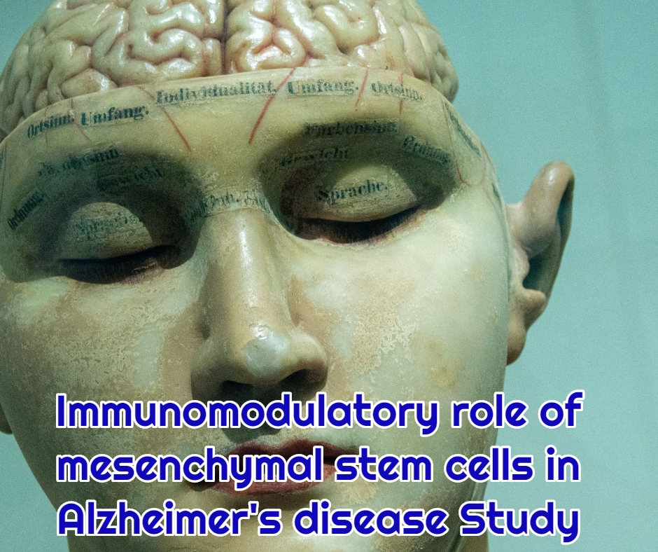 Immunomodulatory role of mesenchymal stem cells in Alzheimer's disease Study at dream body clinic