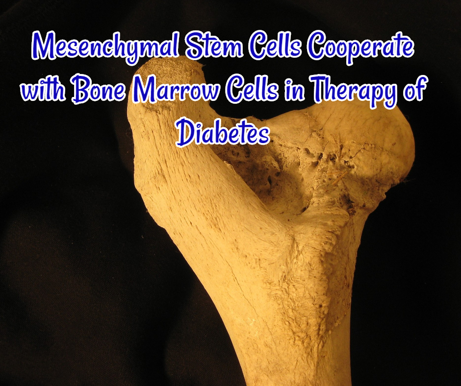 Mesenchymal Stem Cells Cooperate with Bone Marrow Cells in Therapy of Diabetes