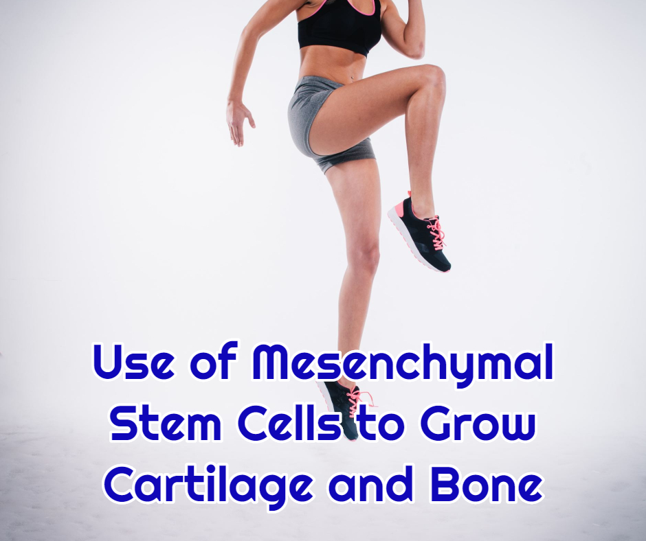 Use of Mesenchymal Stem Cells to Grow Cartilage and Bone at dream body clinic stem cell therapy