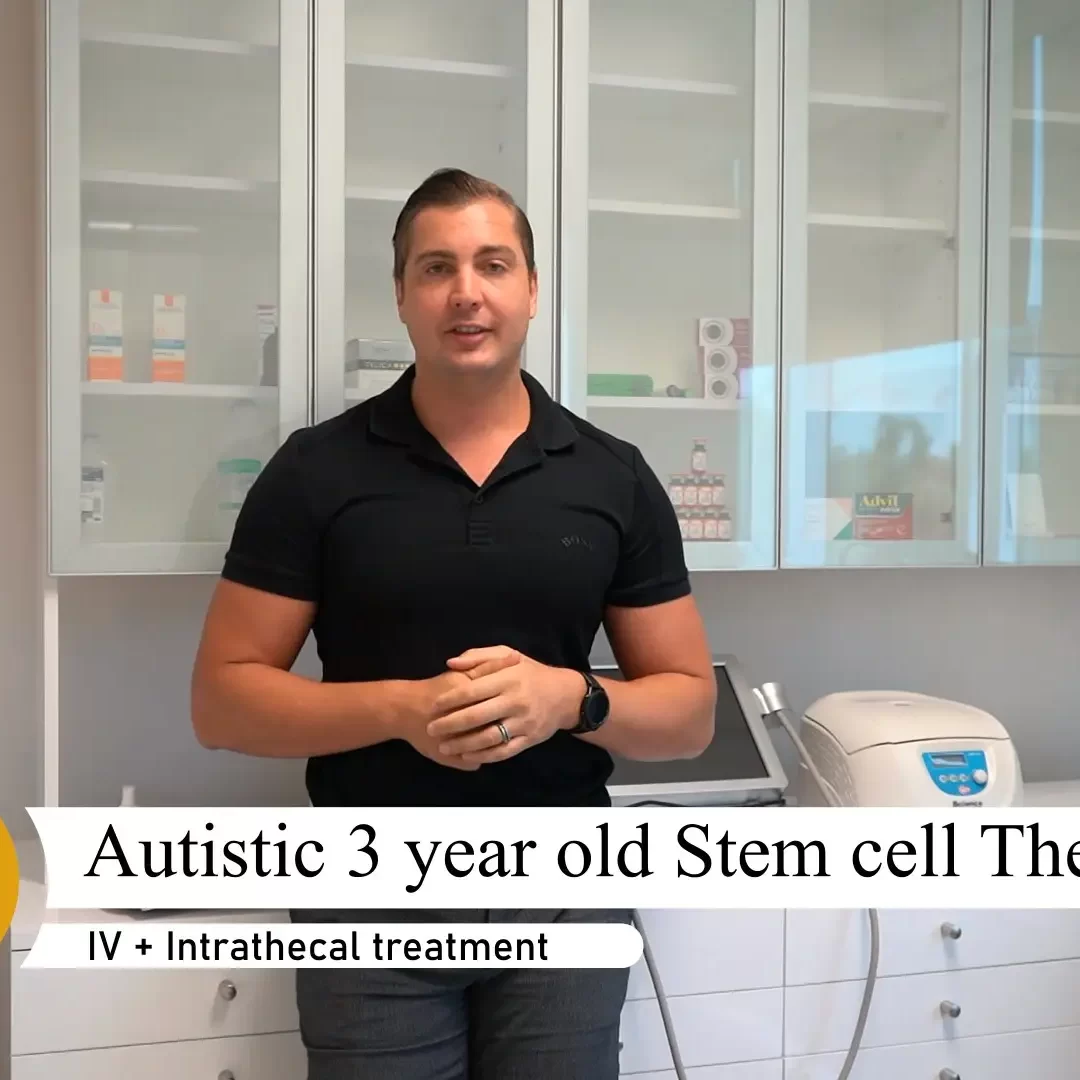 Autiistic 3 year old stem cell Therapy_Moment Autistic 3 year old stem cell therapy at dream body clinic