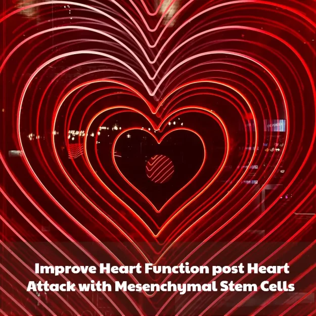 Improve Heart Function post Heart Attack with Mesenchymal Stem Cells