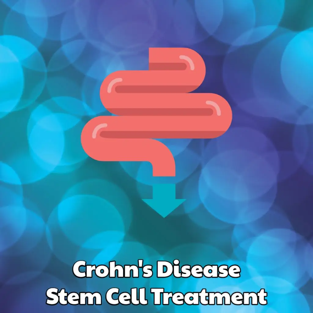 Crohns Disease Stem Cell Treatment Dream Body Clinic