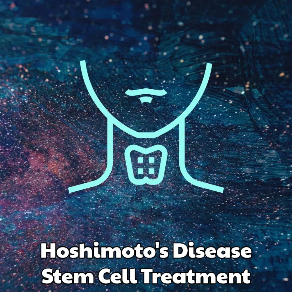 Hoshimotos Disease Stem Cell Treatment Dream Body Clinic