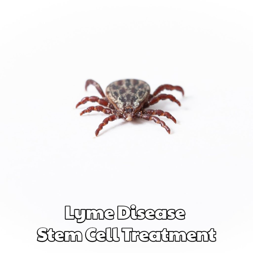 Lyme Disease Stem Cell Treatment