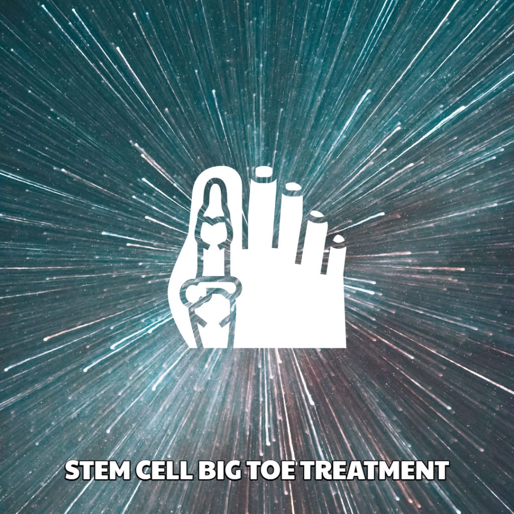 Stem Cell Big Toe Treatment Dream Body Clinic