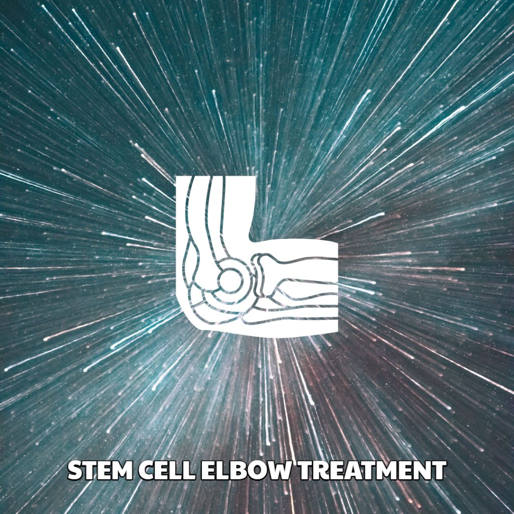 Stem Cell Elbow Treatment