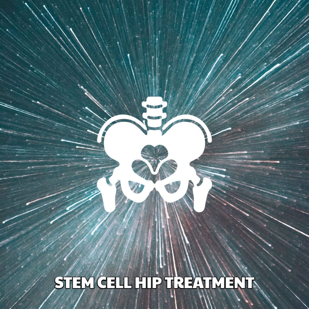 Stem Cell Hip Treatment