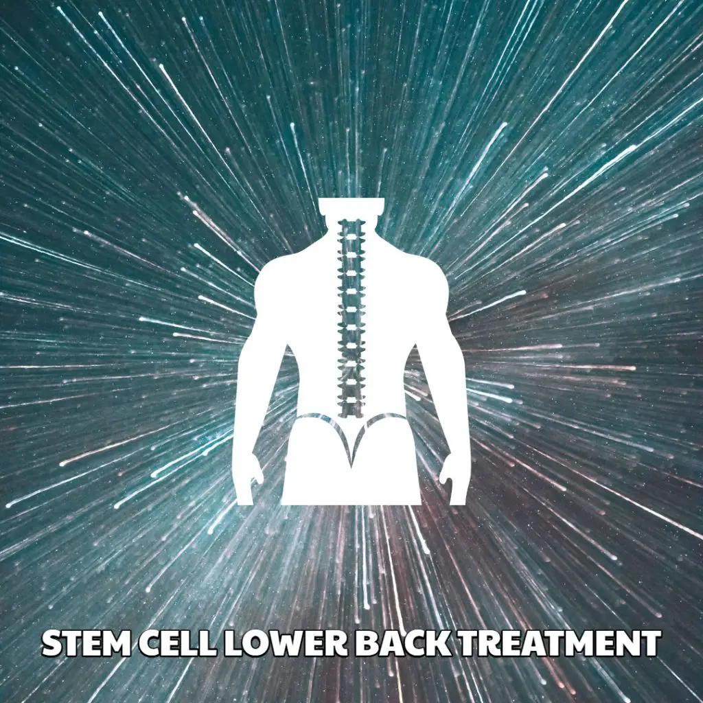 Lower Back Stem Cell Treatment
