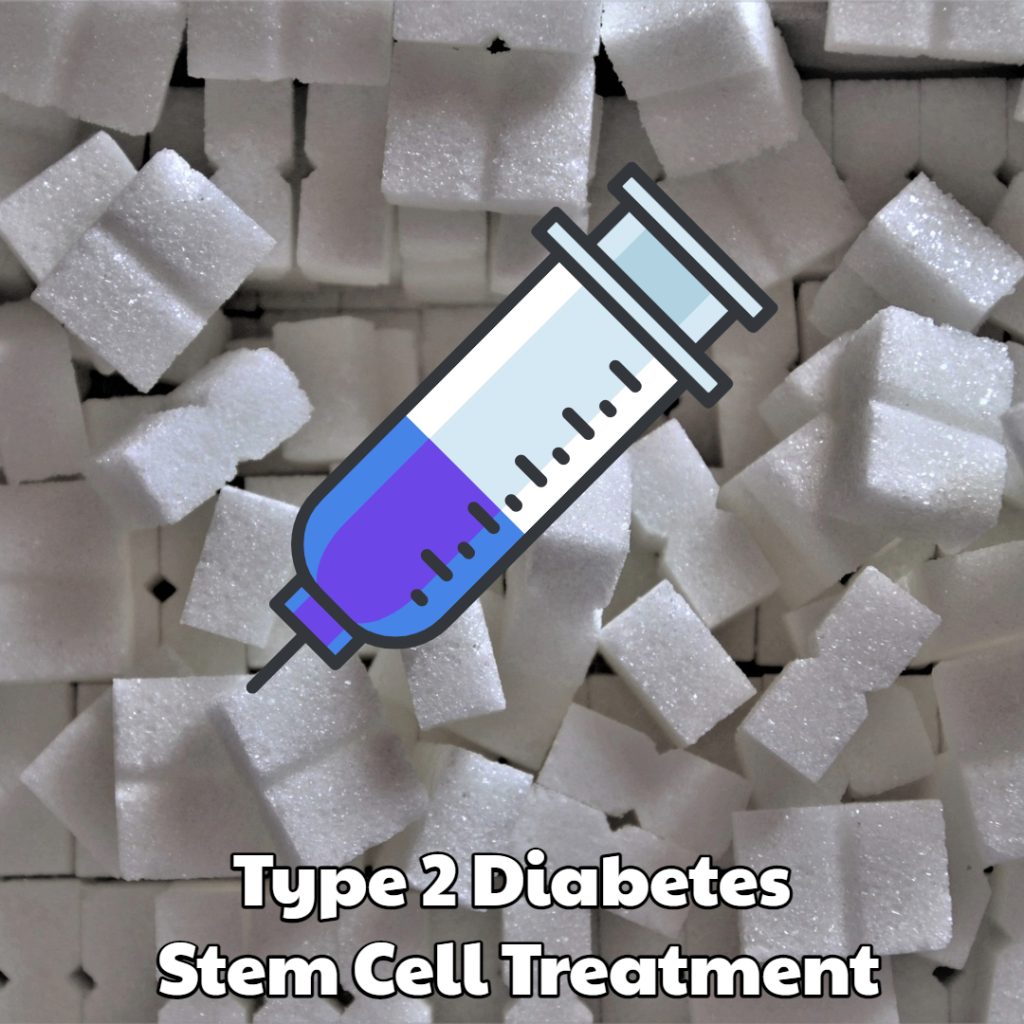 Type 2 Diabetes Stem Cell Treatment Dream Body Clinic