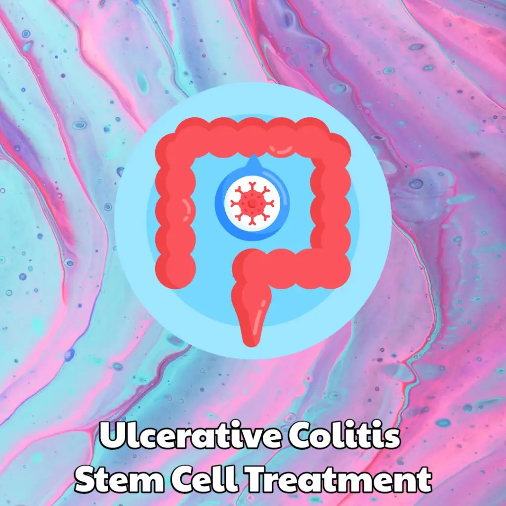 Ulcerative Colitis Stem Cell Treatment