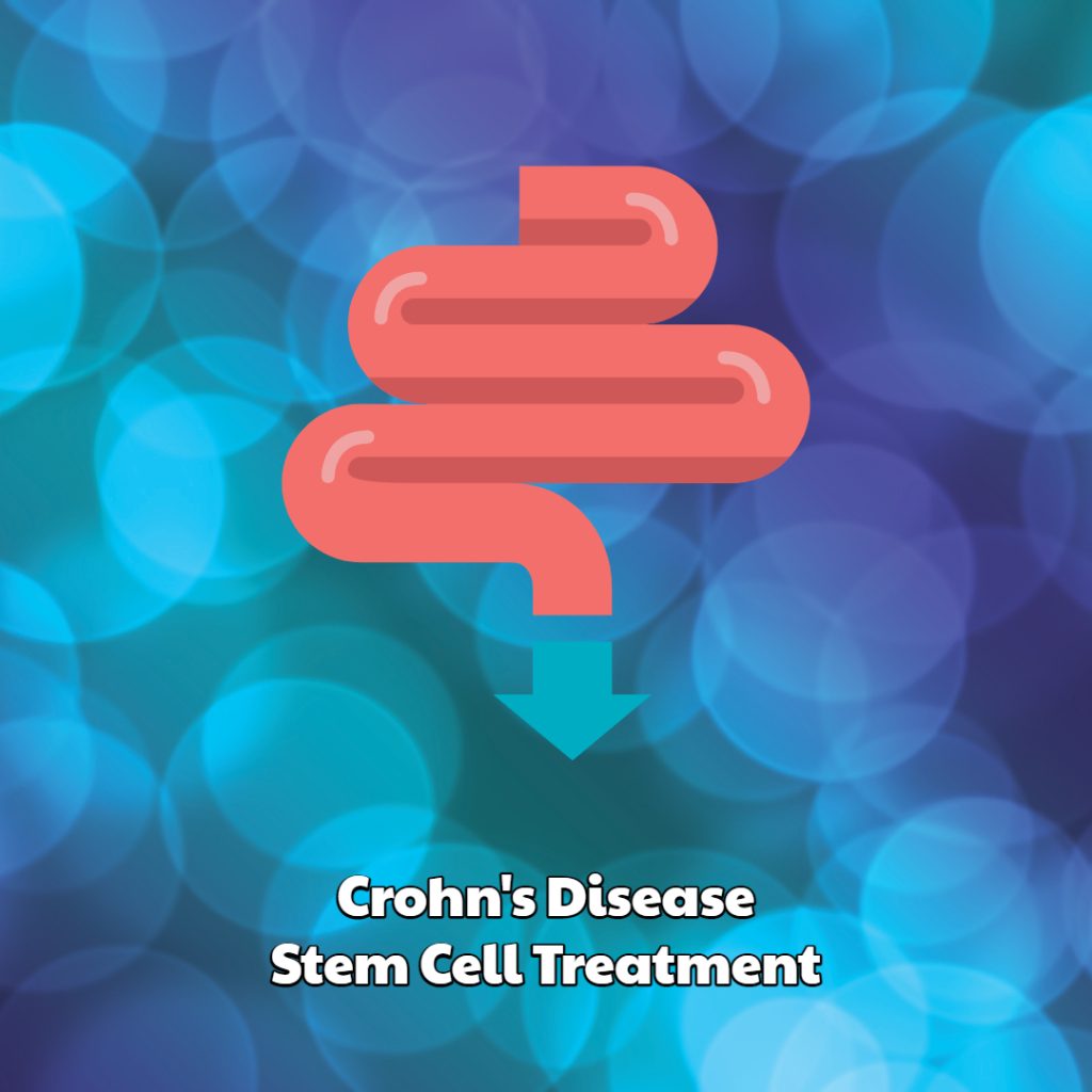 Crohn’s Disease Stem Cell Treatment
