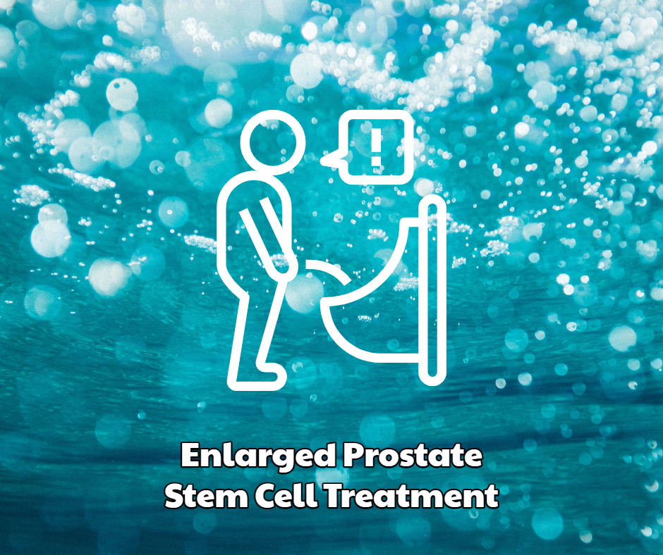Enlarged Prostate Stem Cell Treatment