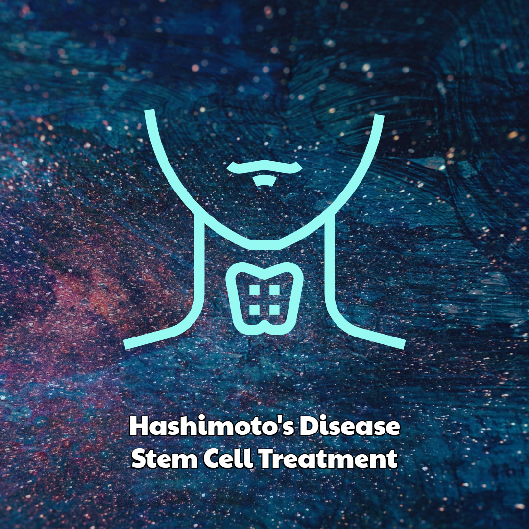 hashimoto-s-disease-stem-cell-treatment-dreambody-clinic