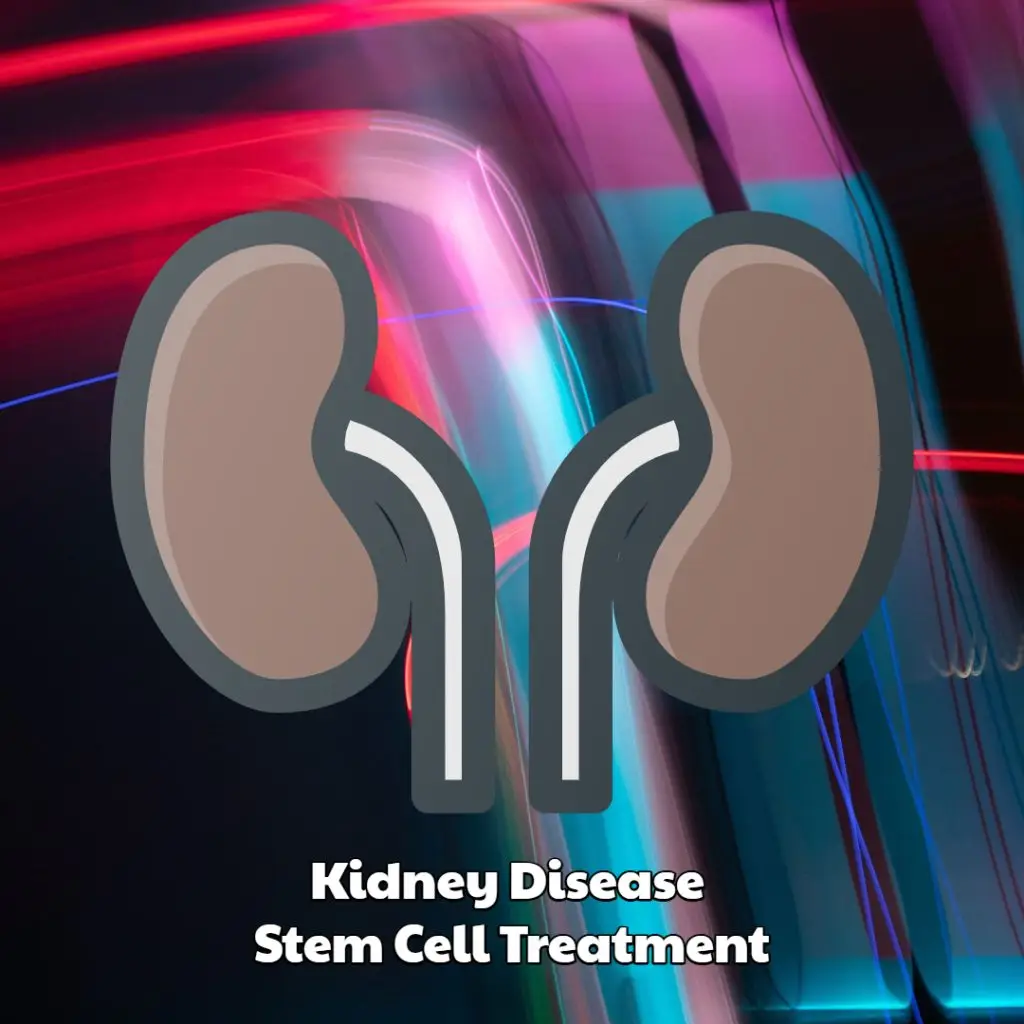 Kidney Disease Stem Cell Treatment