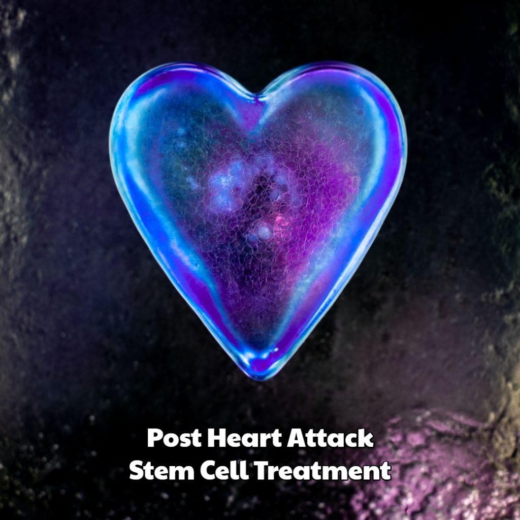 Post Heart Attack Stem Cell Treatment