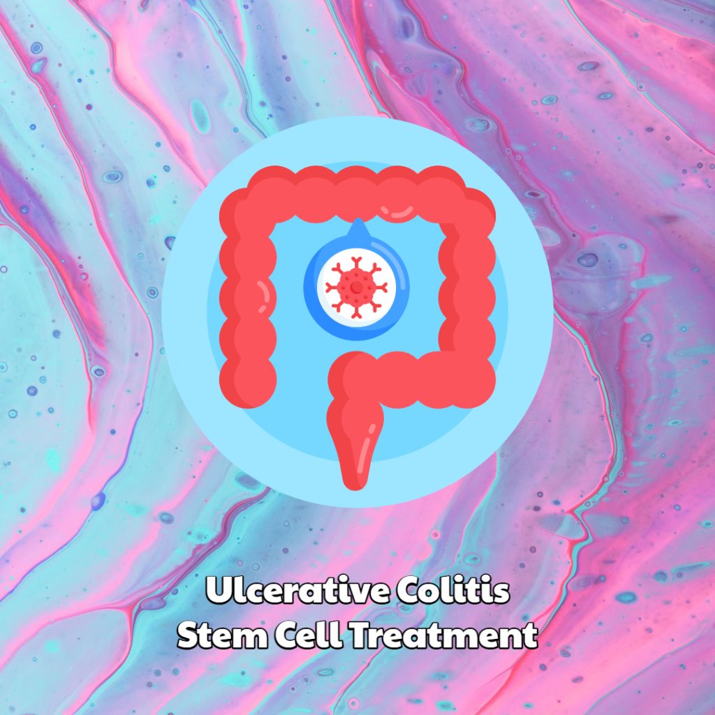 Ulcerative Colitis Stem Cell Treatment