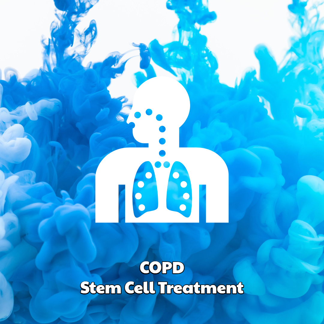 Copd Stem Cell Treatment Dreambody Clinic