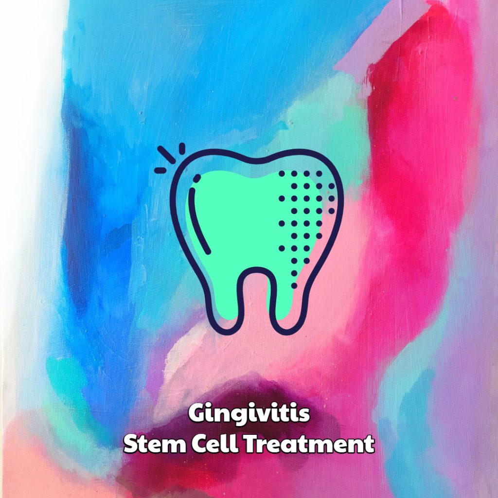 Gingivitis Stem Cell Treatment