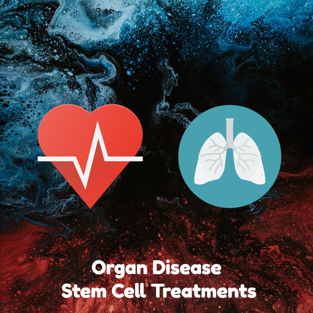 Organ Disease Stem Cell Treatments