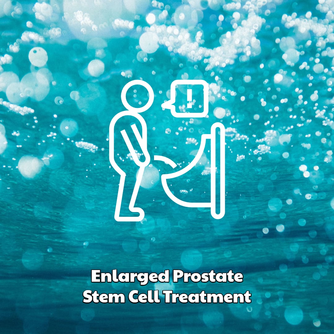 enlarged prostate stem cell treatment 