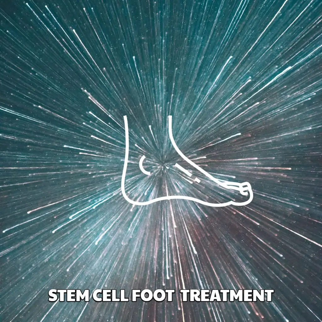 Foot Stem Cell Treatment Dream Body Clinic