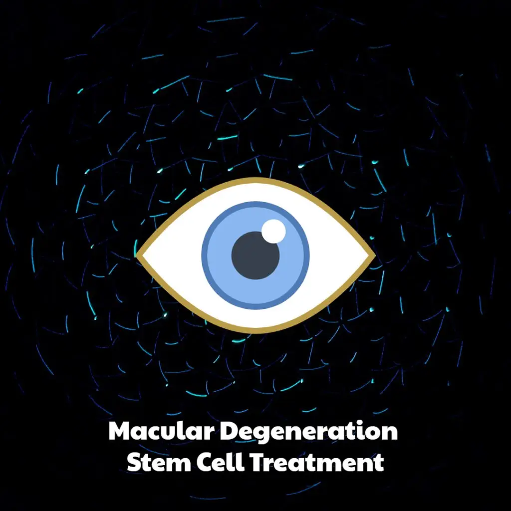 Macular Degeneration Stem Cell Treatment