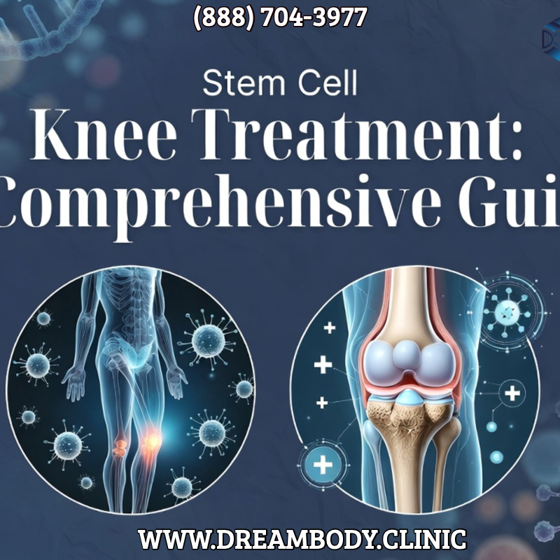 stem cell knee treatment comprehensive guide 2026 dream body clinic