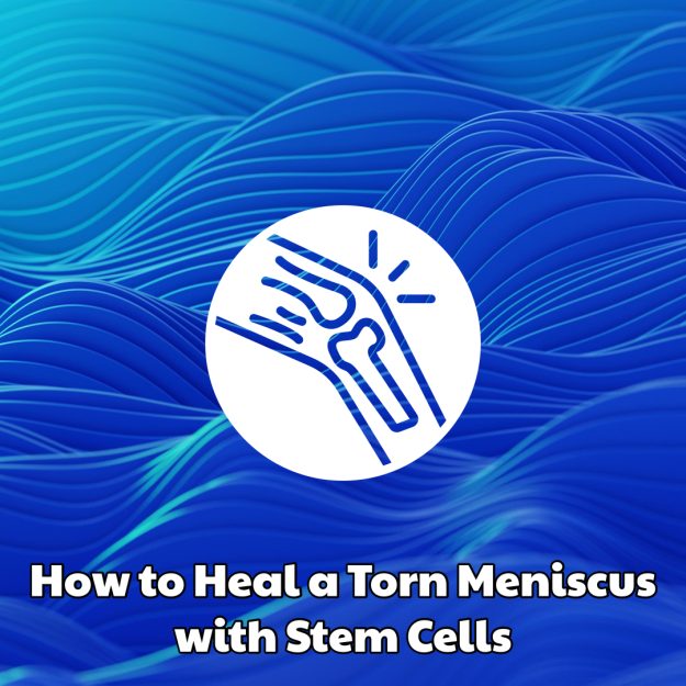 How to Heal a Torn Meniscus with Stem Cells
