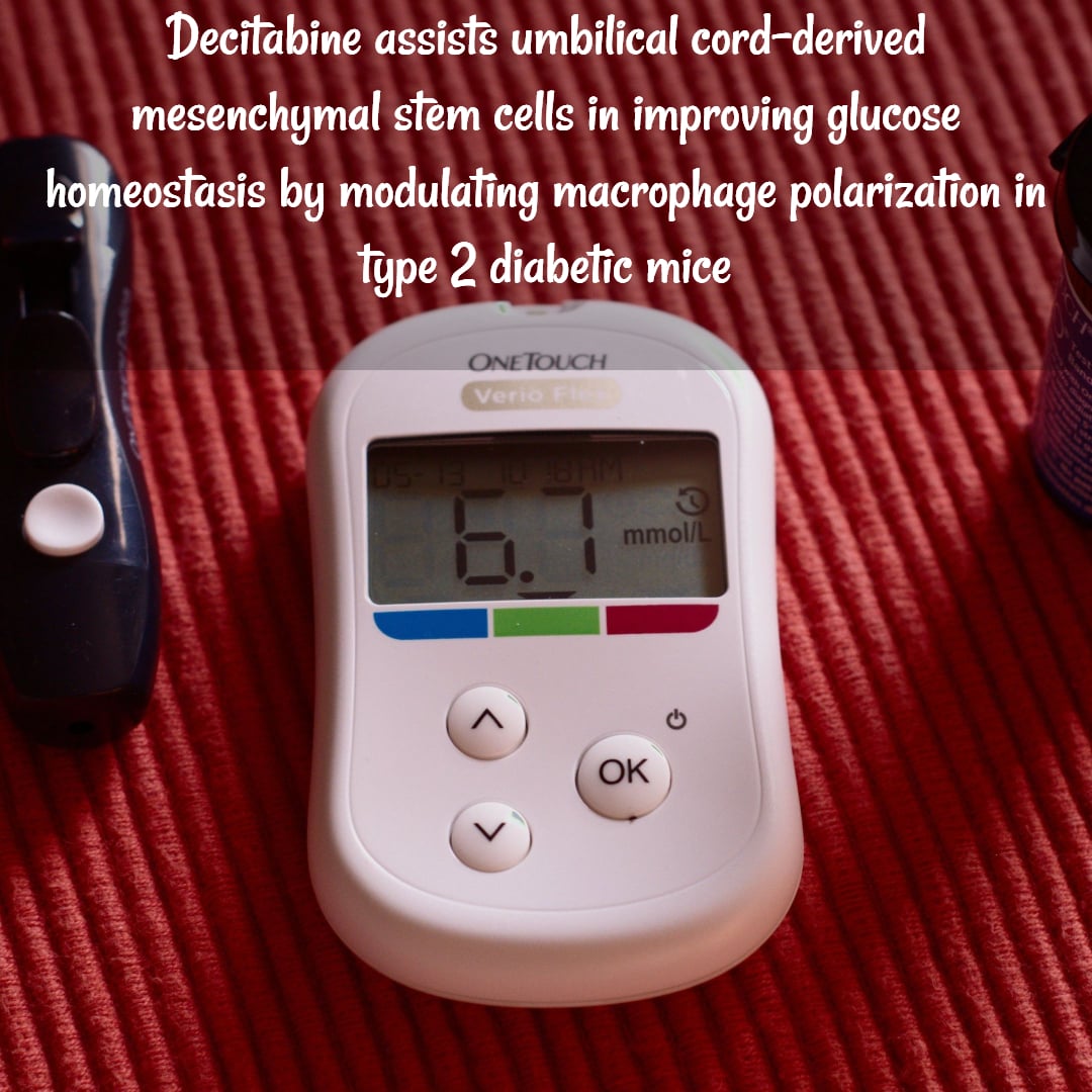Decitabine assists umbilical cord derived mesenchymal stem cells in improving glucose homeostasis by modulating macrophage polar