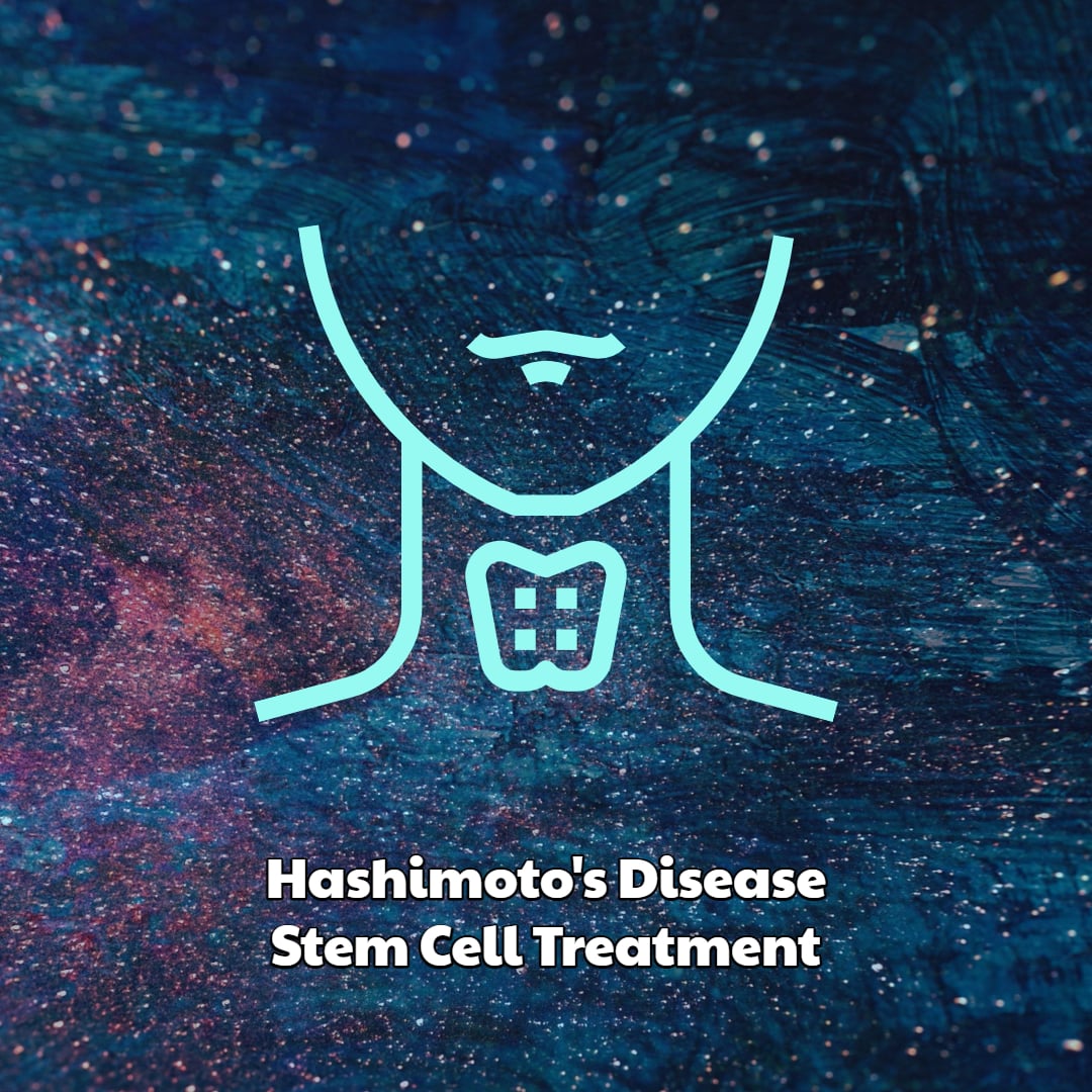 Stem Cell Hashimoto's Disease Treatment