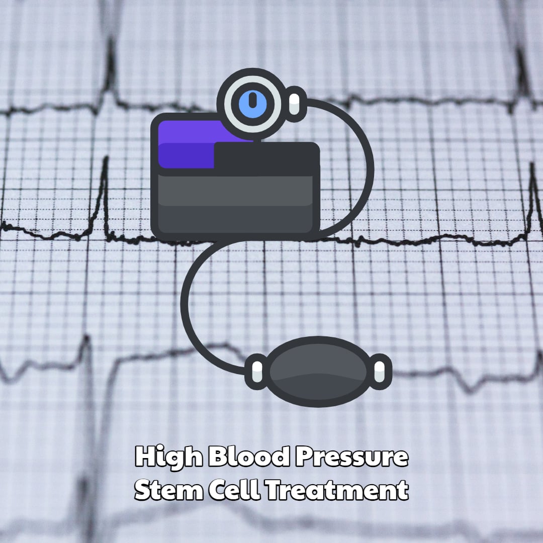 Stem Cell High Blood Pressure Treatment