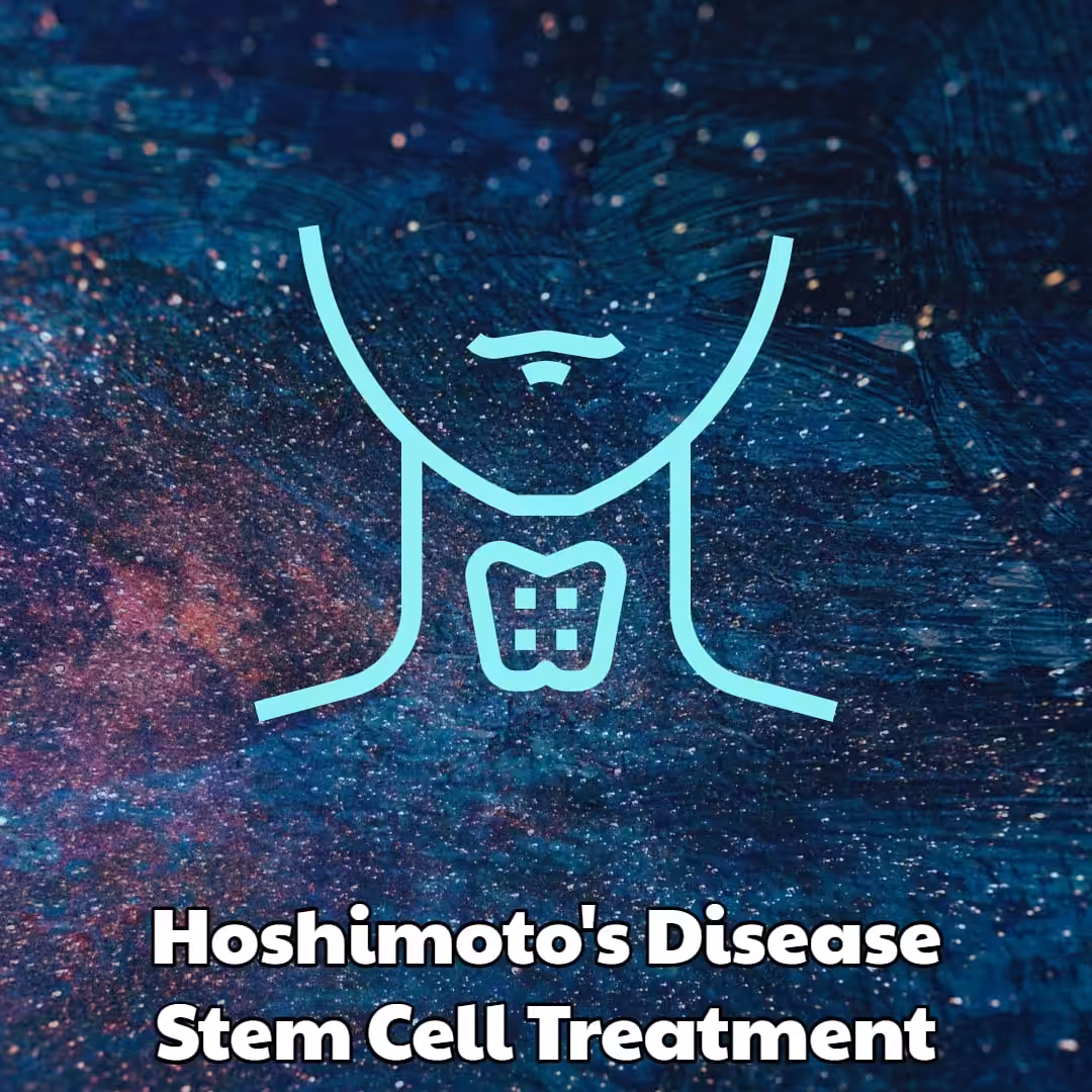Hoshimotos Disease Stem Cell Treatment Dream Body Clinic