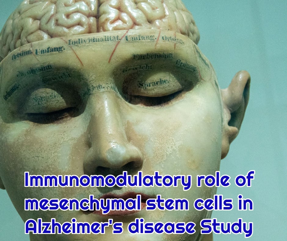 Immunomodulatory role of mesenchymal stem cells in Alzheimers disease Study at dream body clinic